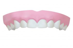 Strahlend lächeln im hohen Alter: Zahnlose Kiefer werden mit Zahnimplantaten versorgt | Zahnarzt Nürnberg